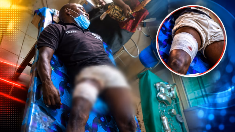 Police hunt gunmen after Community Police Assistant shot